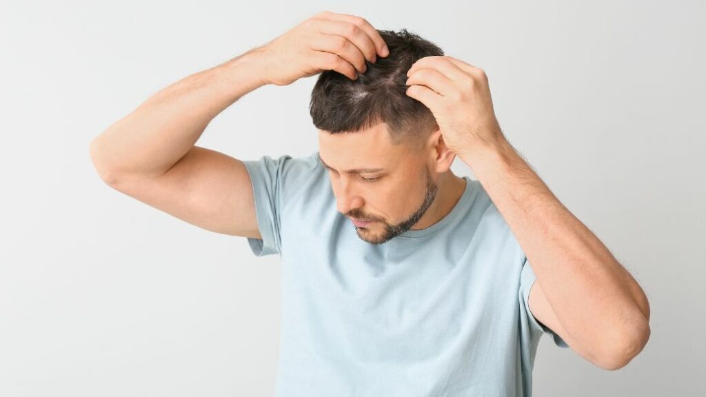 hair loss treatments